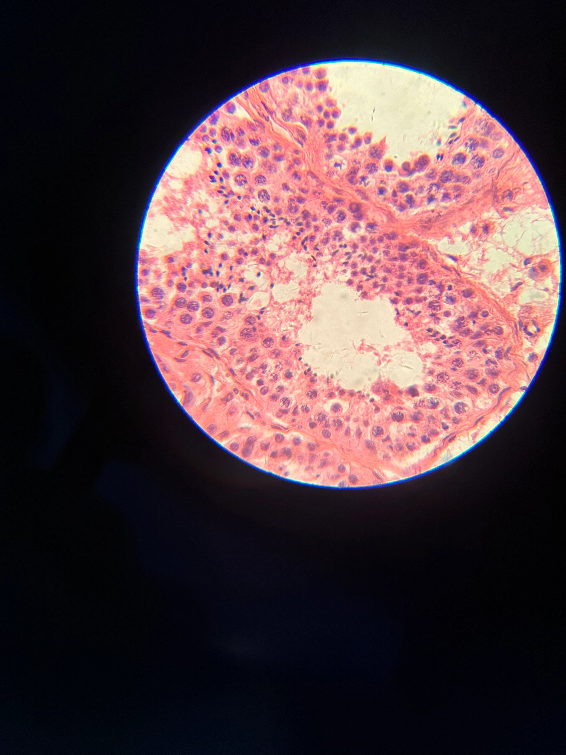 睾丸切片(生精小管,睾丸间质) 别偷啦!