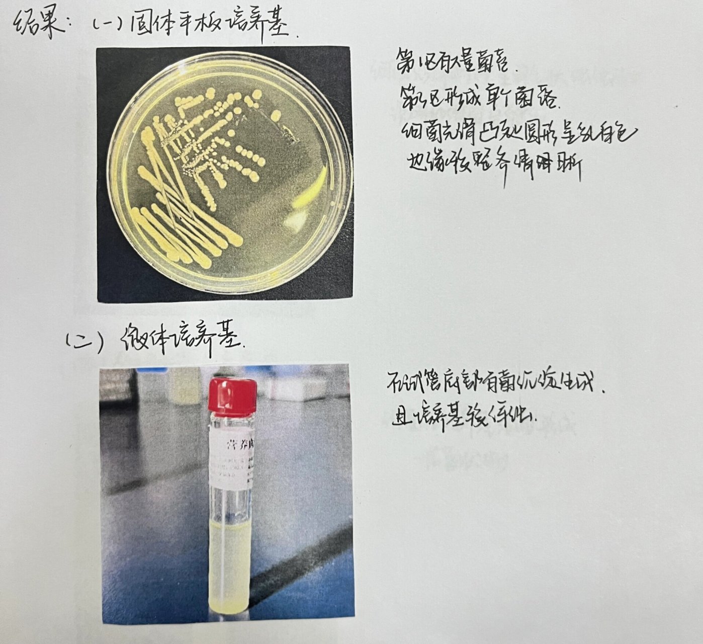 斜面培养基接种图片