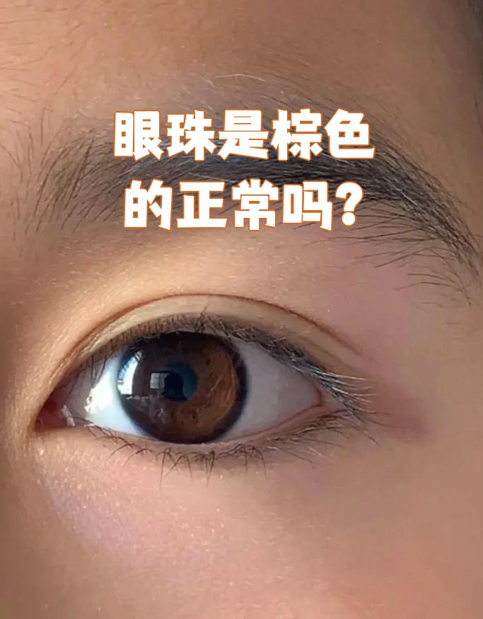 这层膜位于白色巩膜和视网膜之间,最前面有个圆孔叫瞳孔