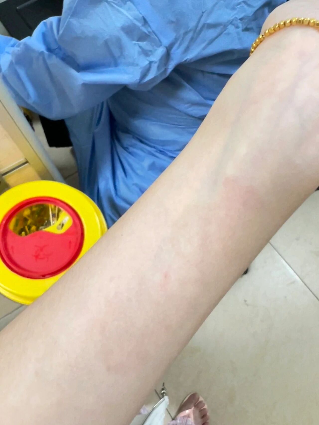 四联14天,结束啦,坐等一个月复查   因为皮试青霉素过敏,所以换了药