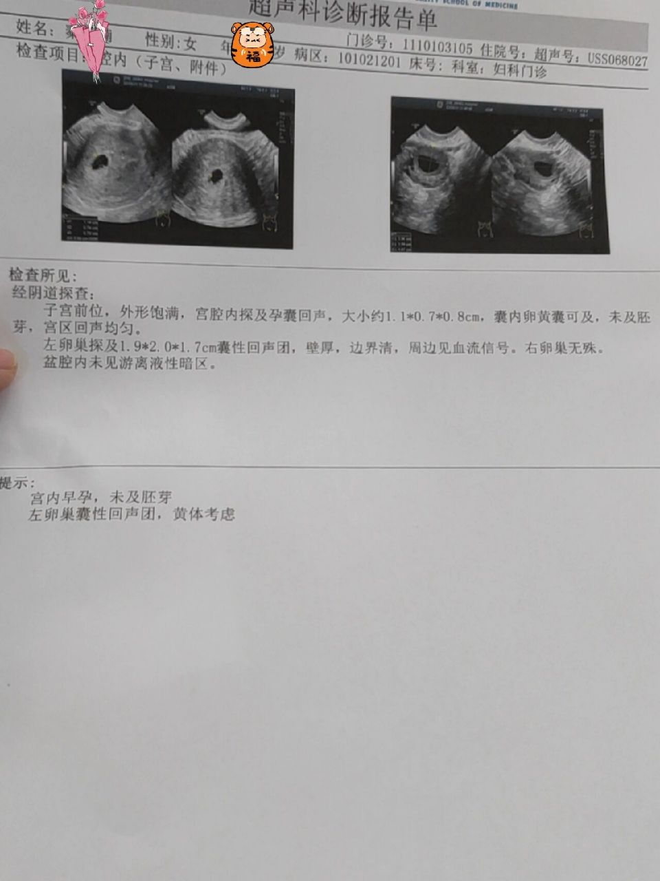 11上午去医院,医生说做个彩超吧,然后排