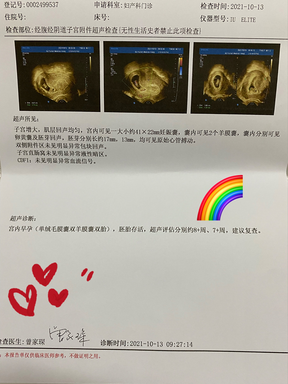 双胞胎后续来啦,单绒双羊,顺利8周 前两天做了b超,查了是单绒双羊～也