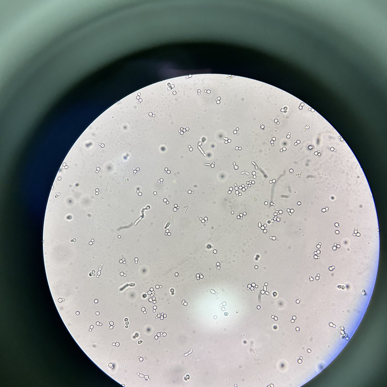 检验科镜检～真菌孢子10 尿液中的哈,很清楚