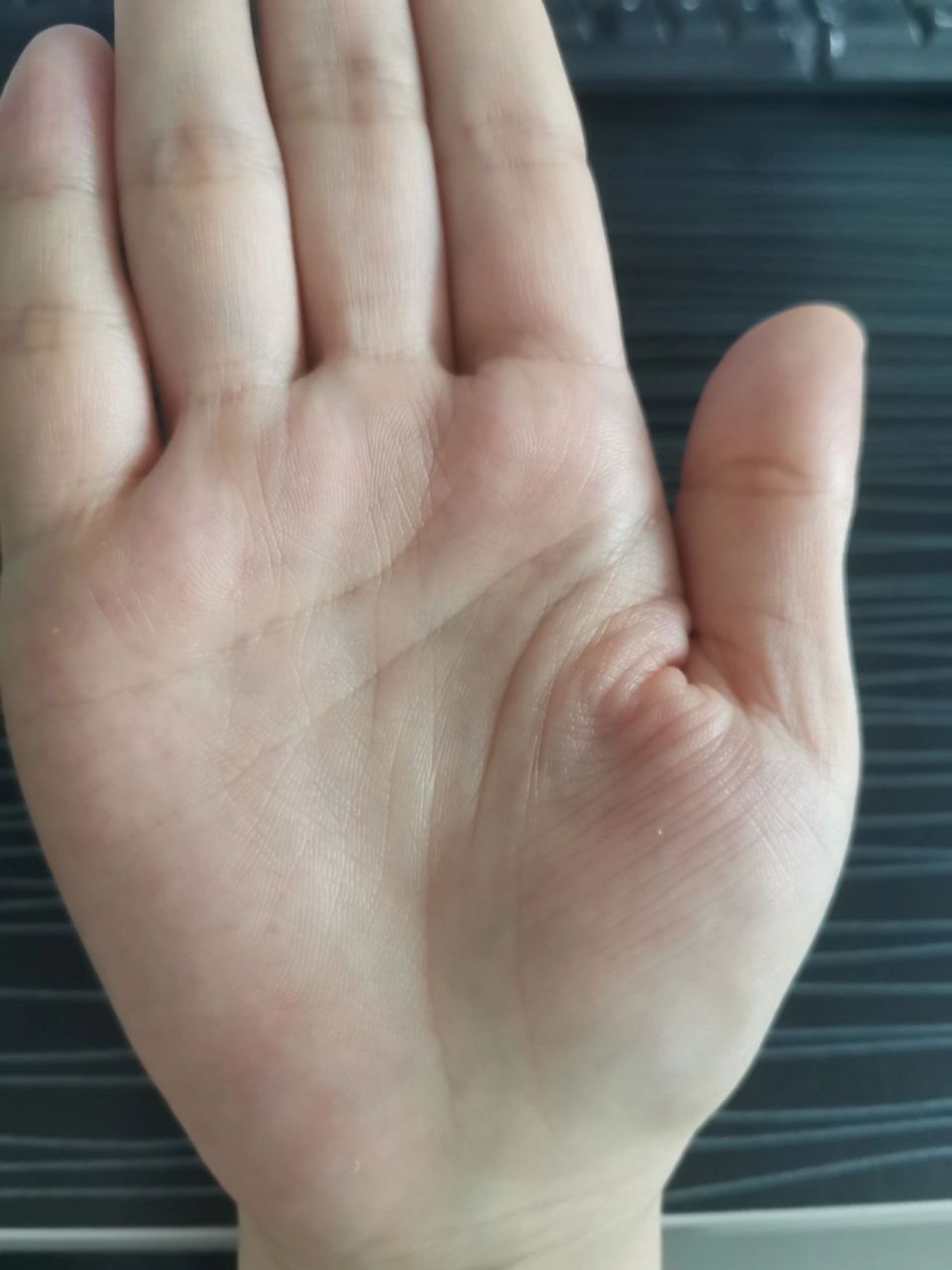 这么短的生命线 这么短的生命线