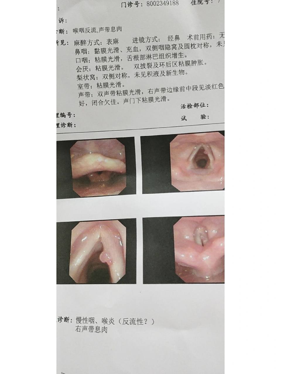 今天行右侧声带息肉手术 最终吃了两个月的药都没好,还是反反复复撕哑