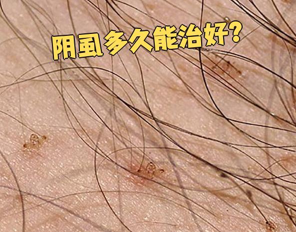 如果阴虱数量少,症状轻,用苯甲酸苄酯或林旦乳膏这类药物,一般7天