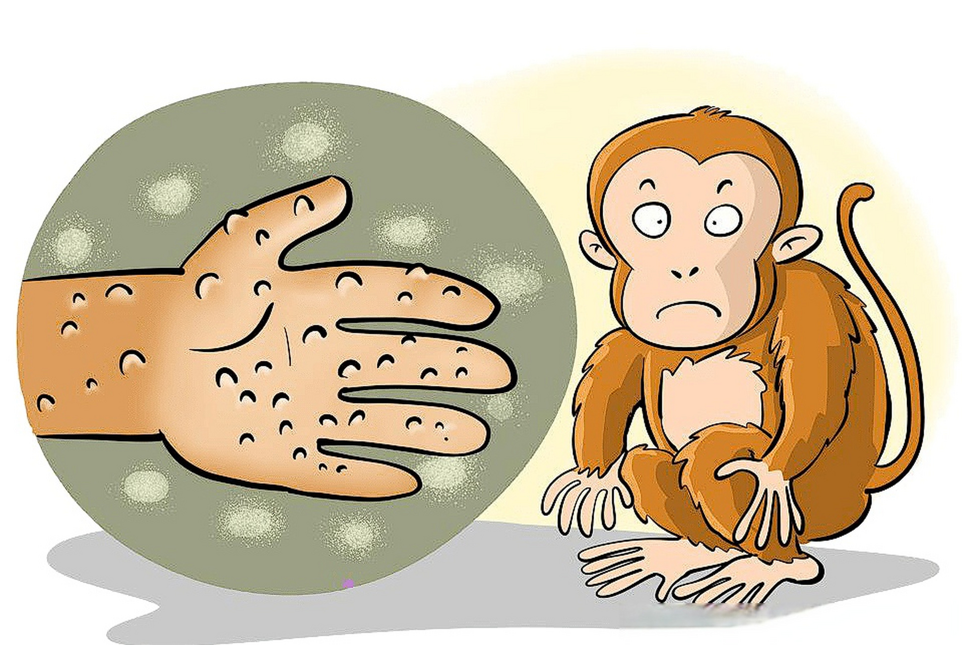 国内多地发现猴痘病例,如何保护自己?