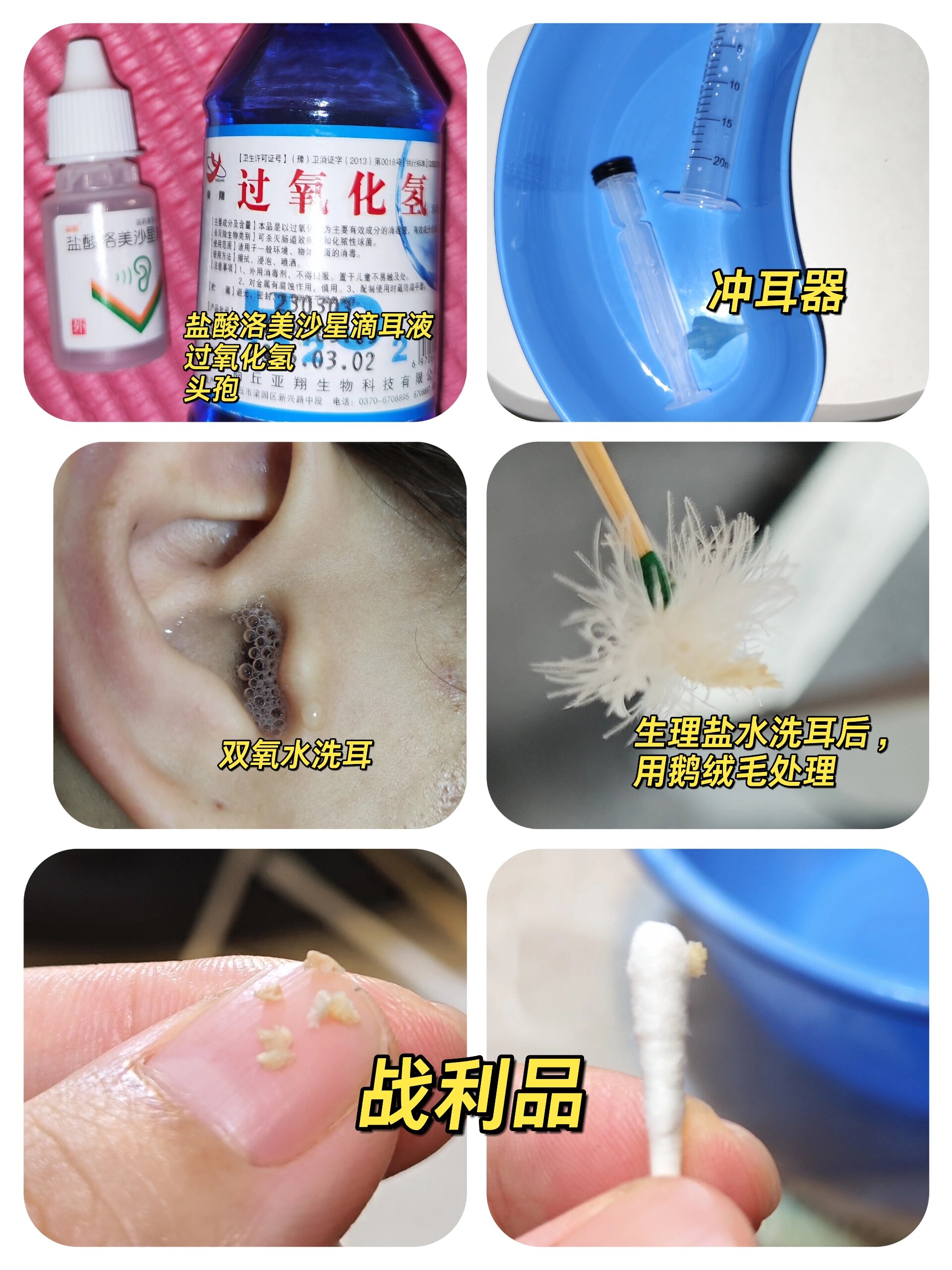 中耳炎自救攻略!我用这方法治好了化脓的耳