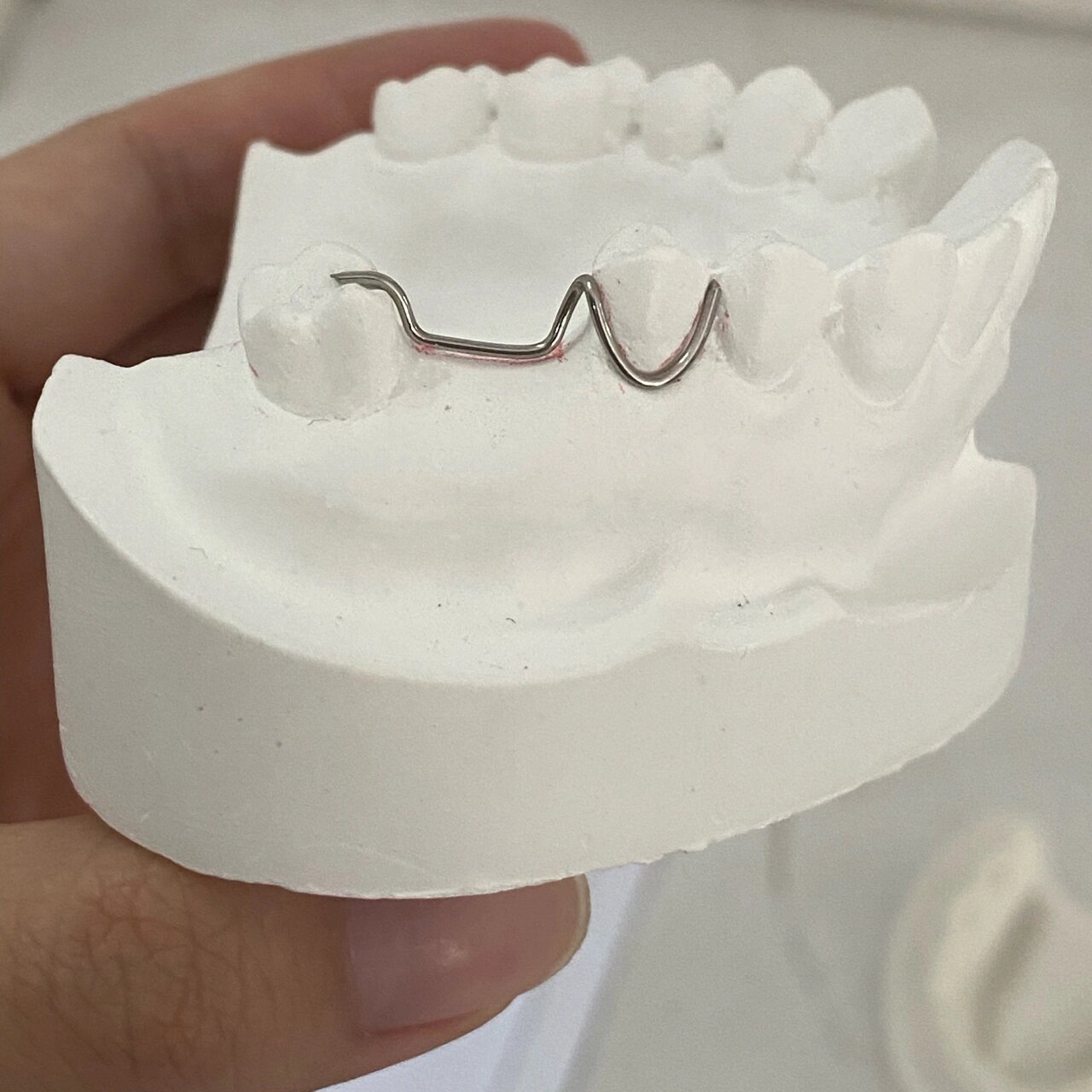 口腔医学日常|可摘局部义齿的制作,弯制卡环 弯卡