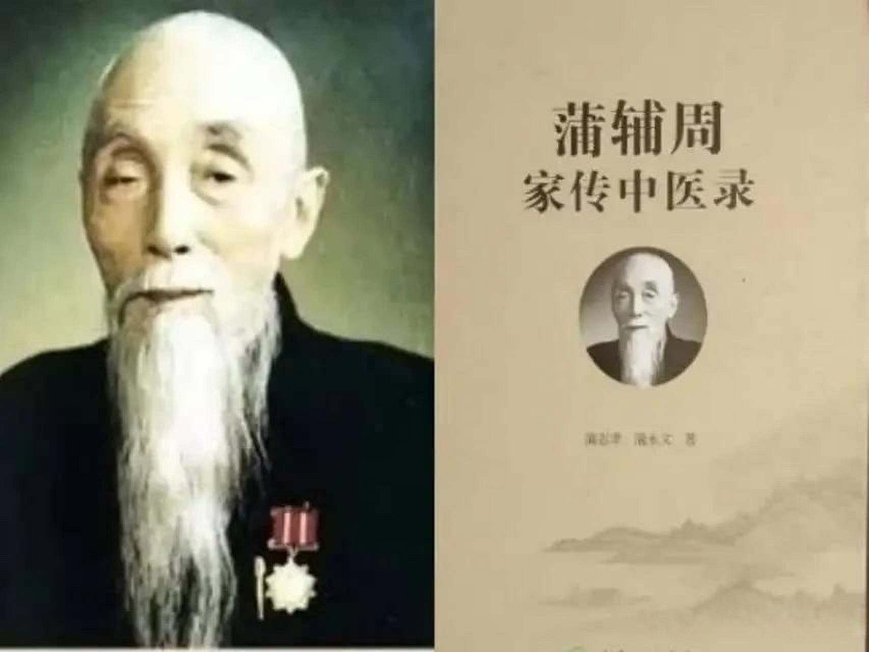 蒲輔周《十味溫膽湯》治療冠心病 導讀——冠心病是冠狀動脈粥樣硬化