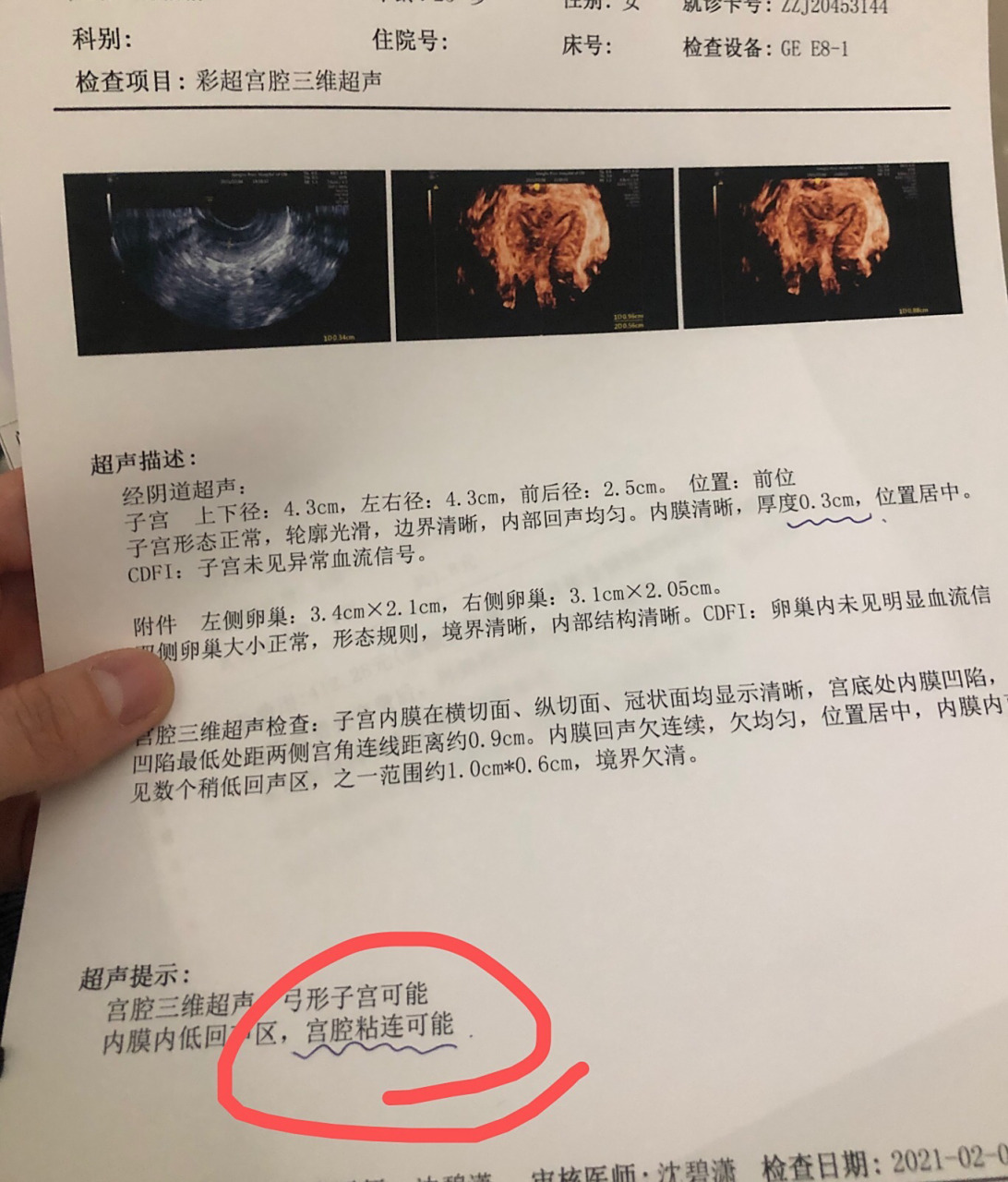 宫腔粘连目前没生育打算,要不要动手术啊? 今年7月中旬人流,第一次.