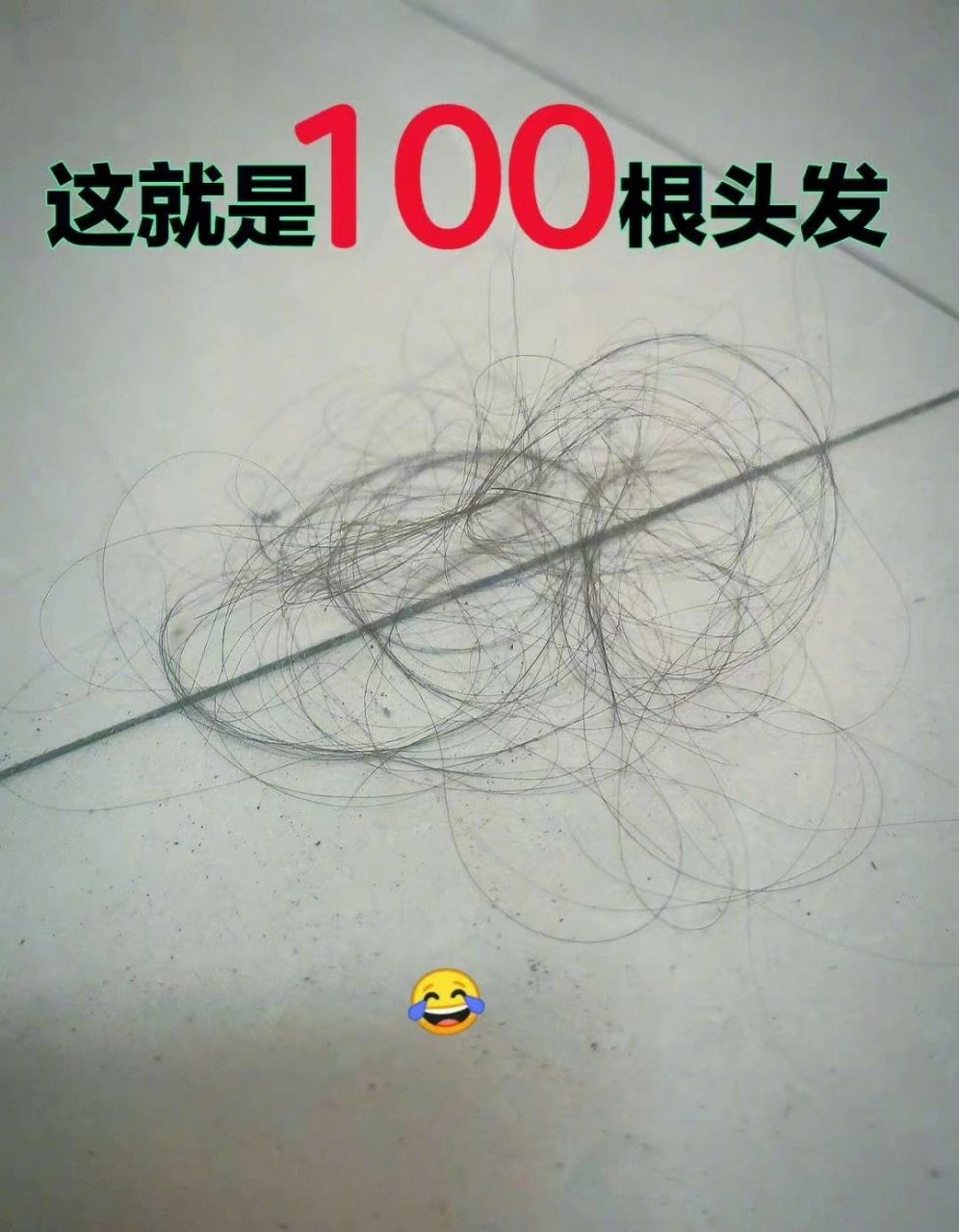 原来100根头发只有这么点 正常人一天掉100根以内头发是正常,超过可能