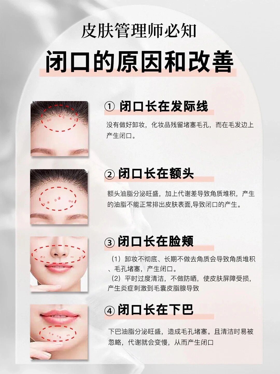 如何清理闭口