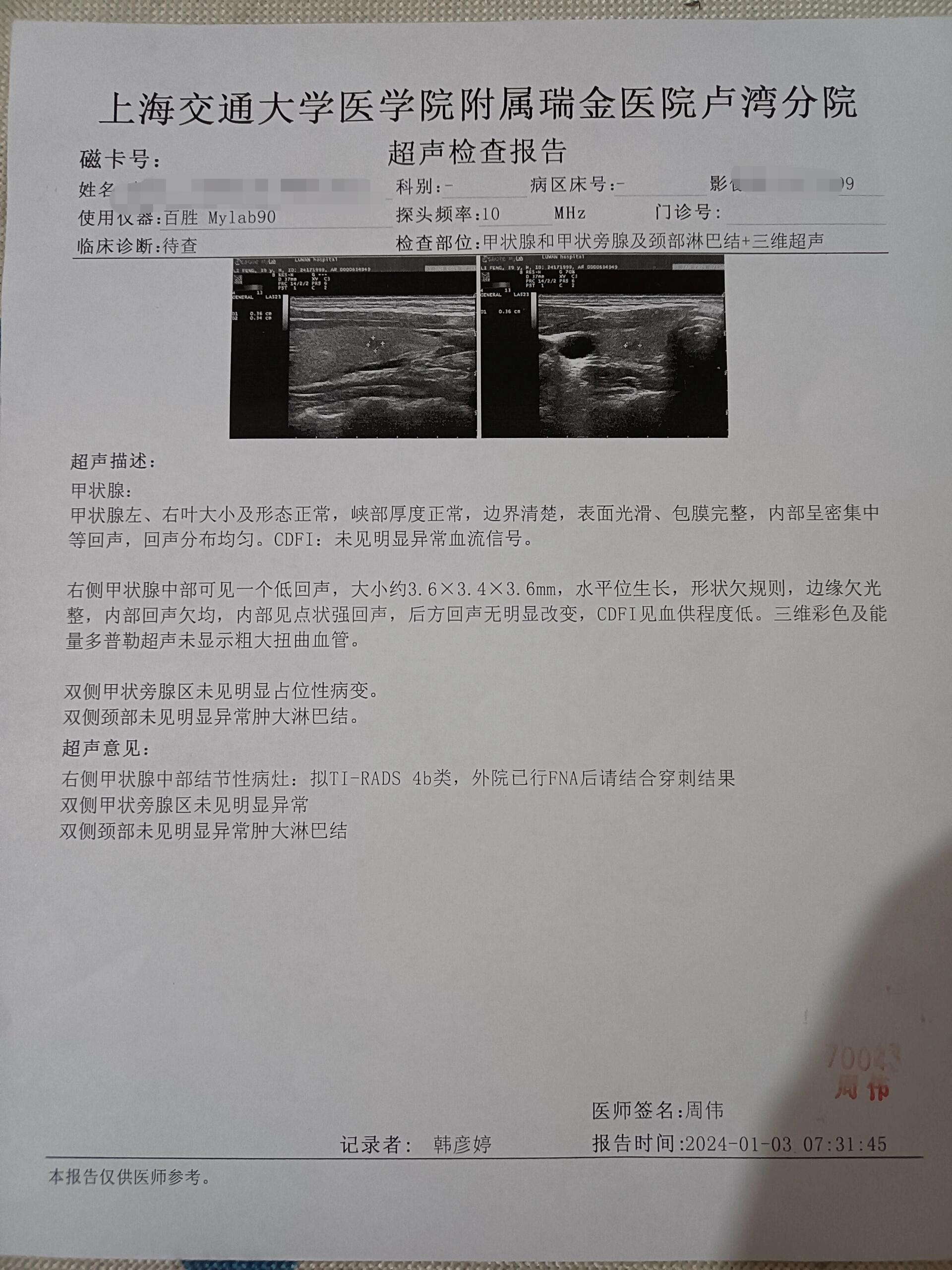 去上海瑞金找周伟医生检查甲状腺!