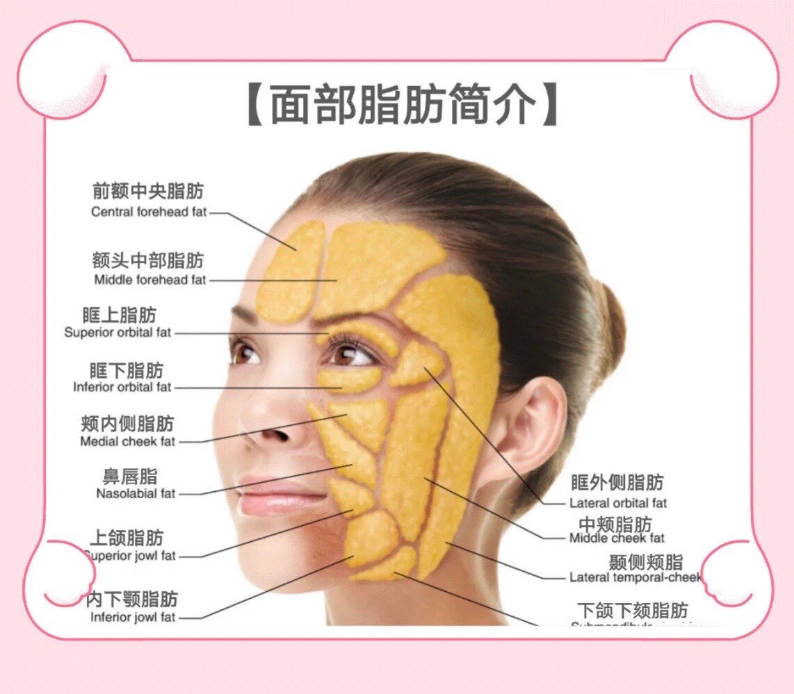 面部脂肪与衰老的关系 面部脂肪也被称为面部脂肪垫 在我们面部不仅起
