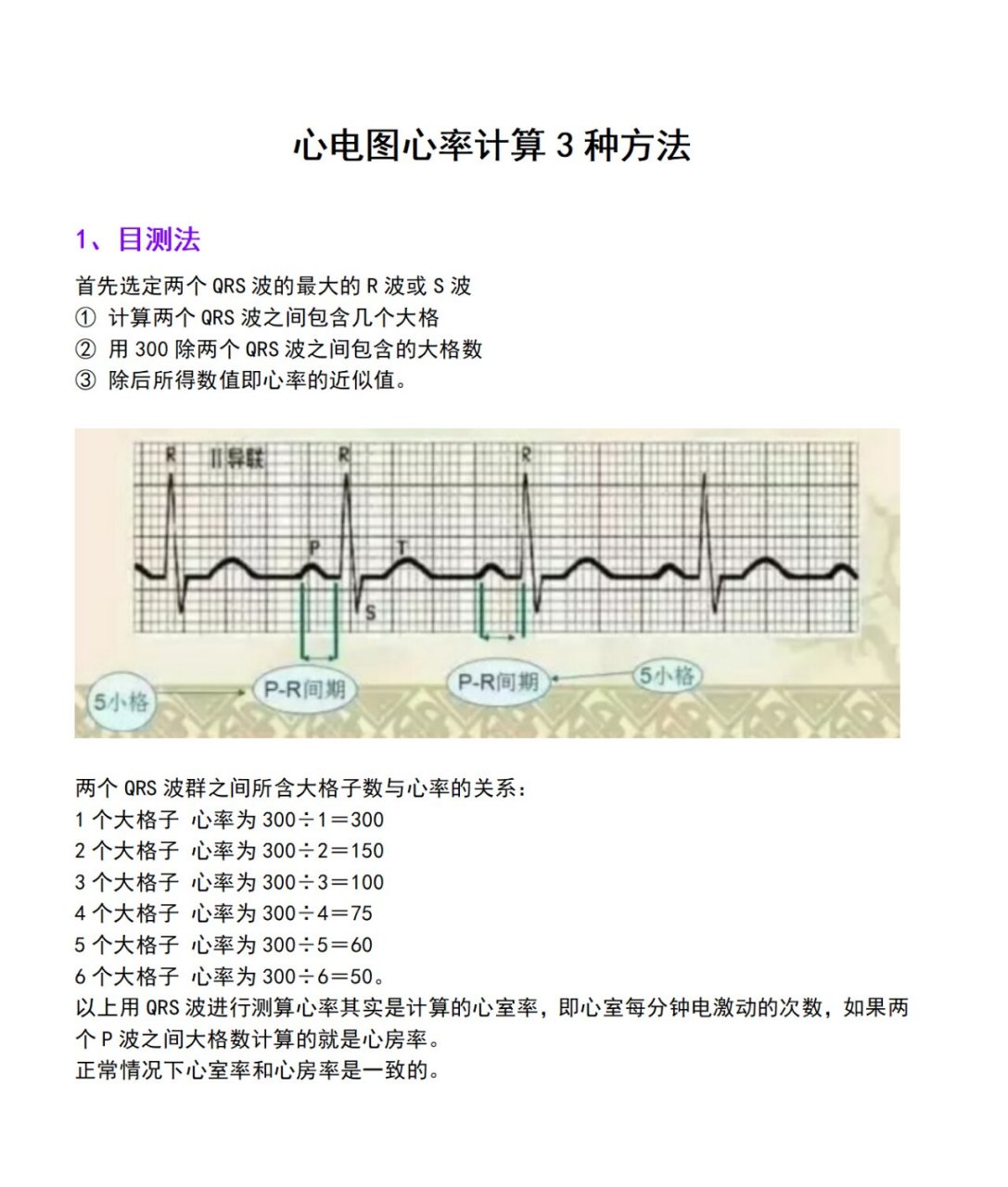 心电图心率计算3种方法