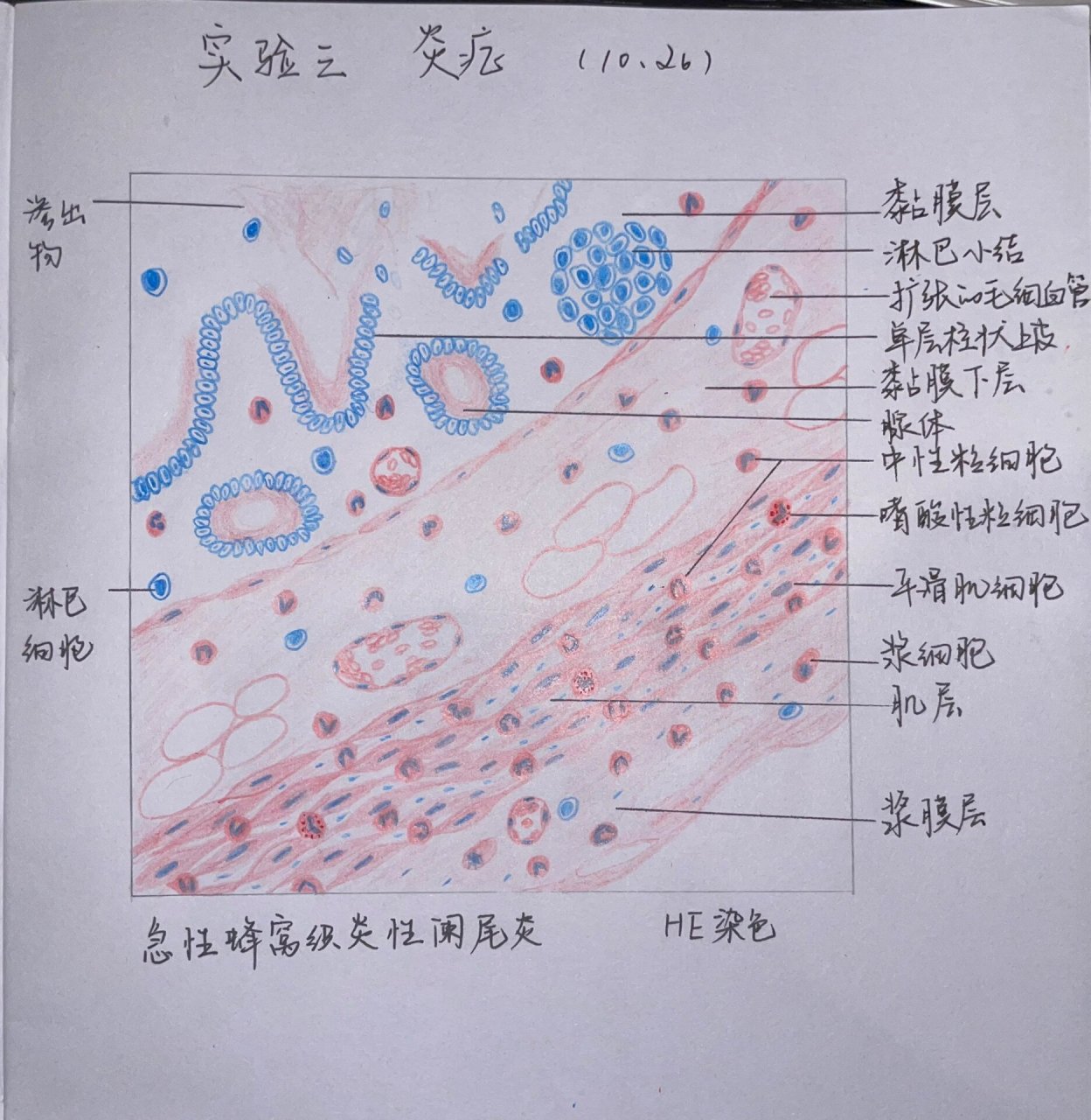 基础医学总论2实验 病理红蓝铅笔手绘图 p1 急性蜂窝织性阑尾炎 p23
