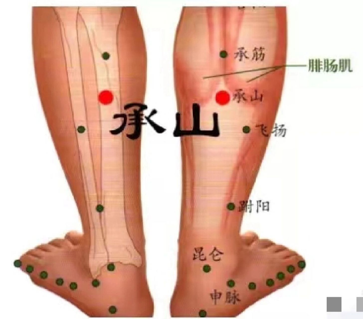 属足太阳膀胱经  位于小腿后区,腓肠肌两肌腹与肌腱交角处