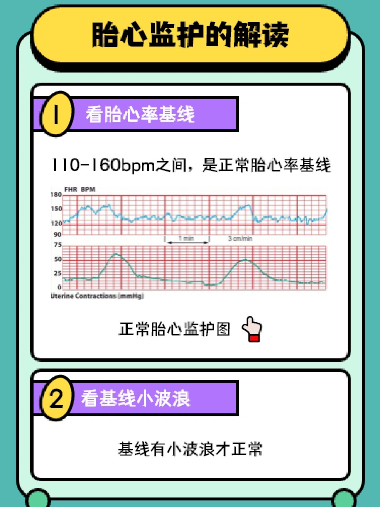 97宫缩 97胎心基线 97基线变异 97胎心加速 97胎心减速