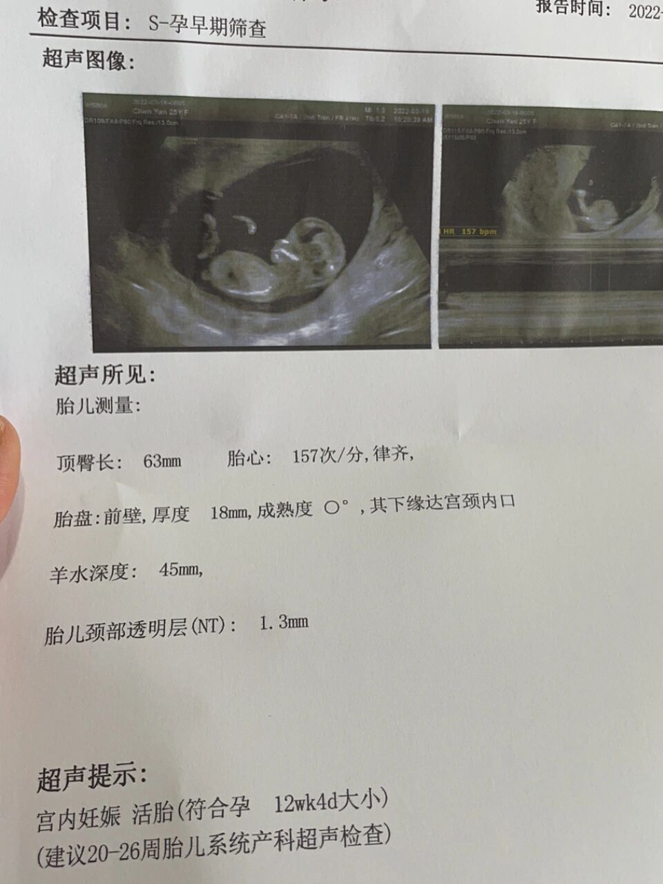 12周nt过了,小宝贝圆圆的脑袋好可爱