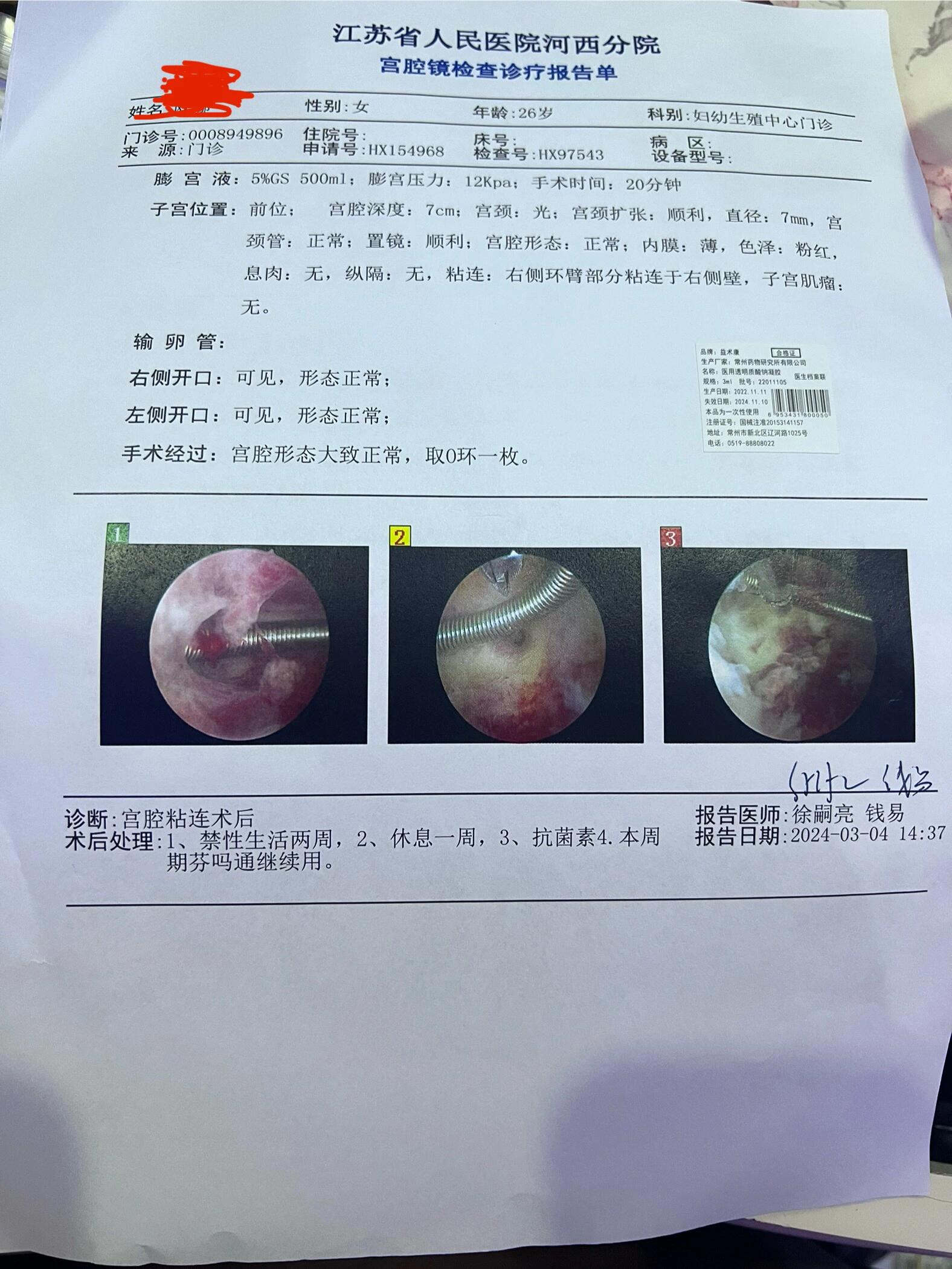 宫腔粘连取环术后