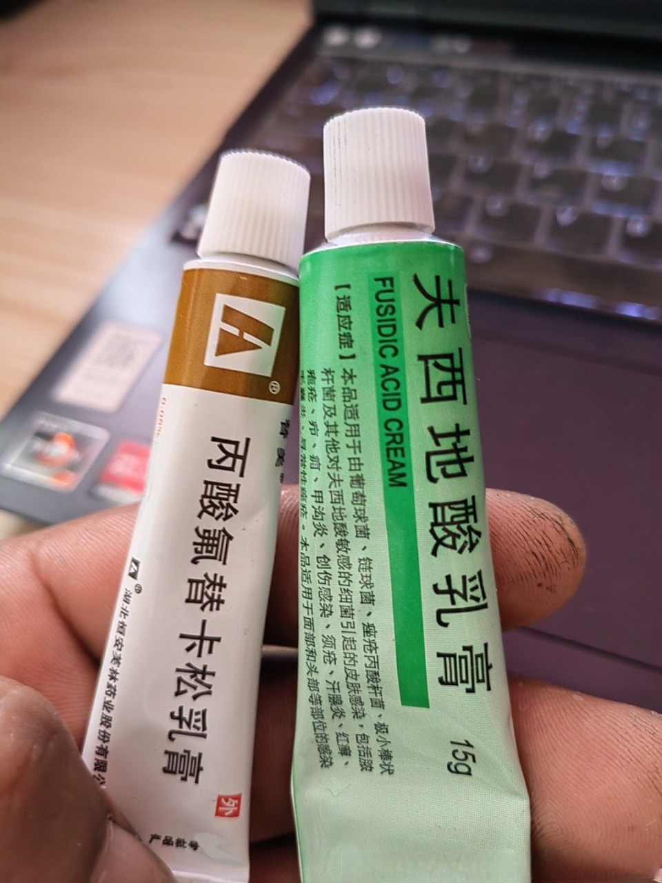 男32岁,大约4月中旬龟头上出现红点,尿道口容易发红不痛不痒,个把星期