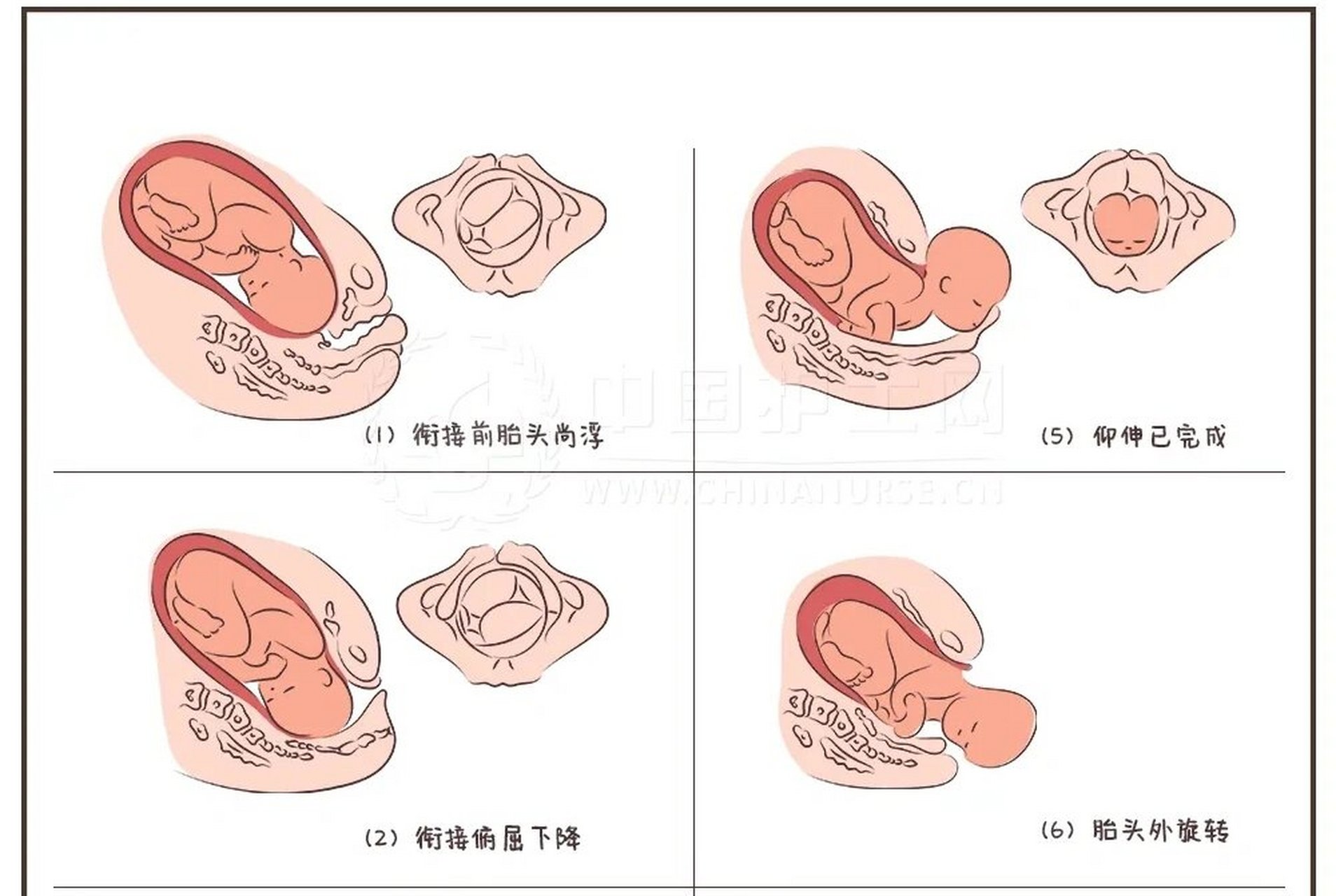 枕后位和枕横位图片图片