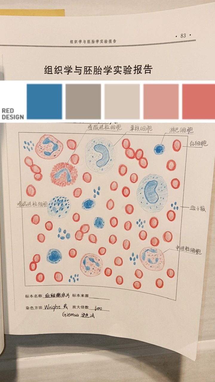 肾脓肿细胞红蓝铅笔图图片