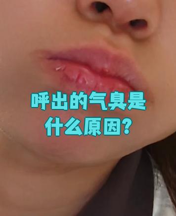 嘴巴好臭是什么原因引起的百科在线