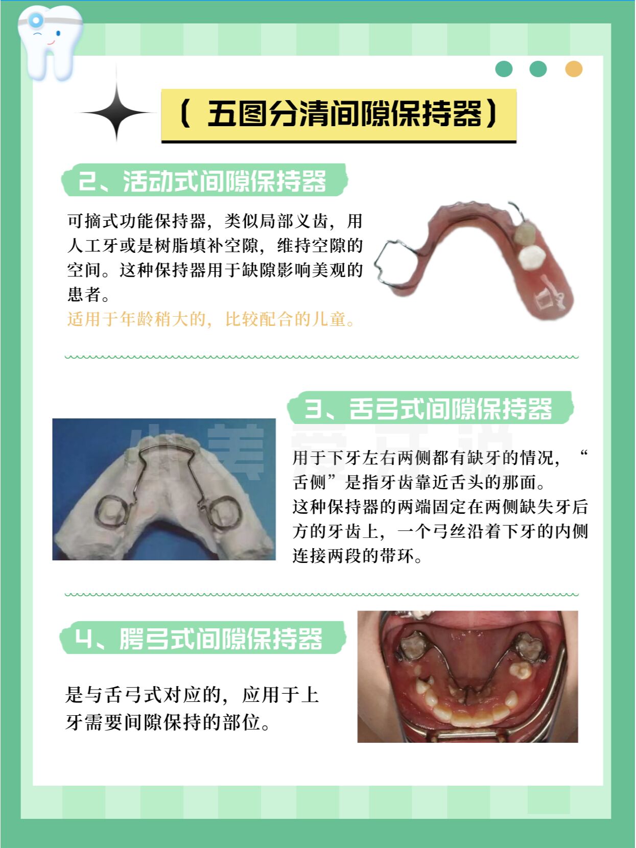 间隙保持器 弊端图片