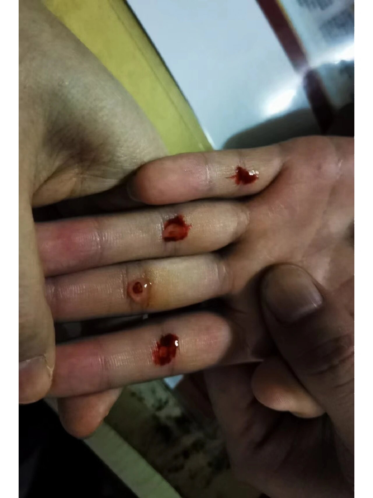 挑疳积长高调理