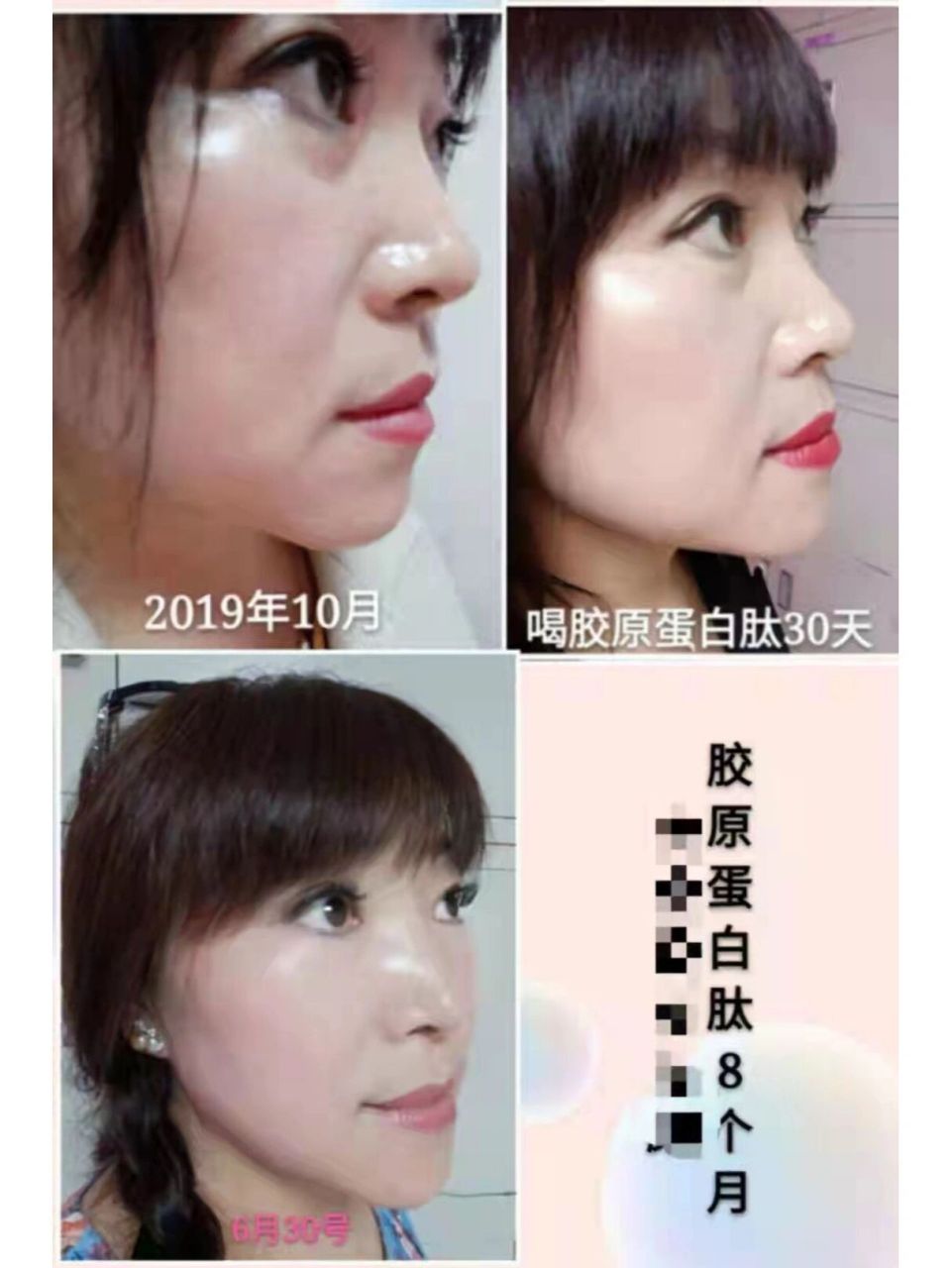 玫琳凯怡日健胶原蛋白肽的服用效果 第一:胶原蛋白肽是什么?