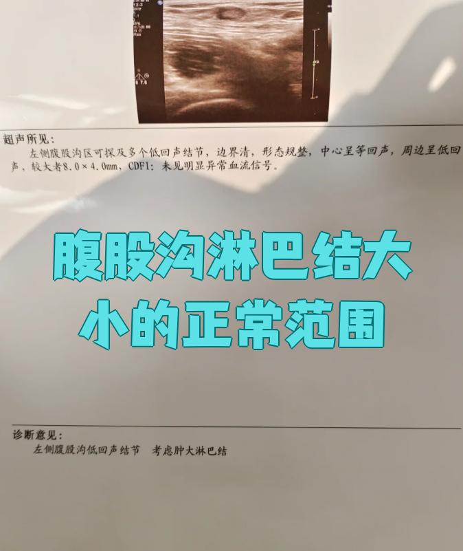 腹股沟淋巴结大小的正常范围