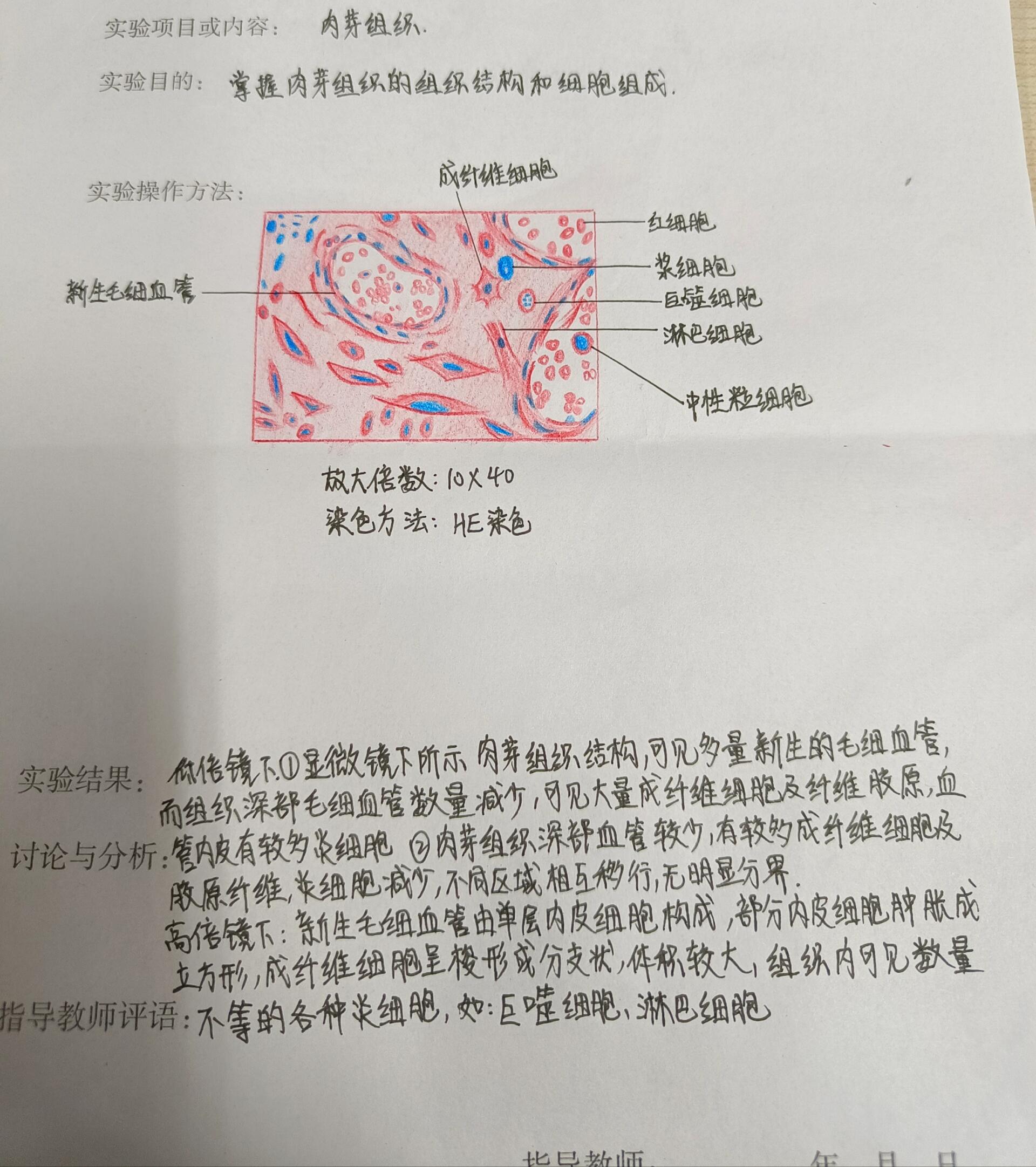 肝淤血图片带标注图片