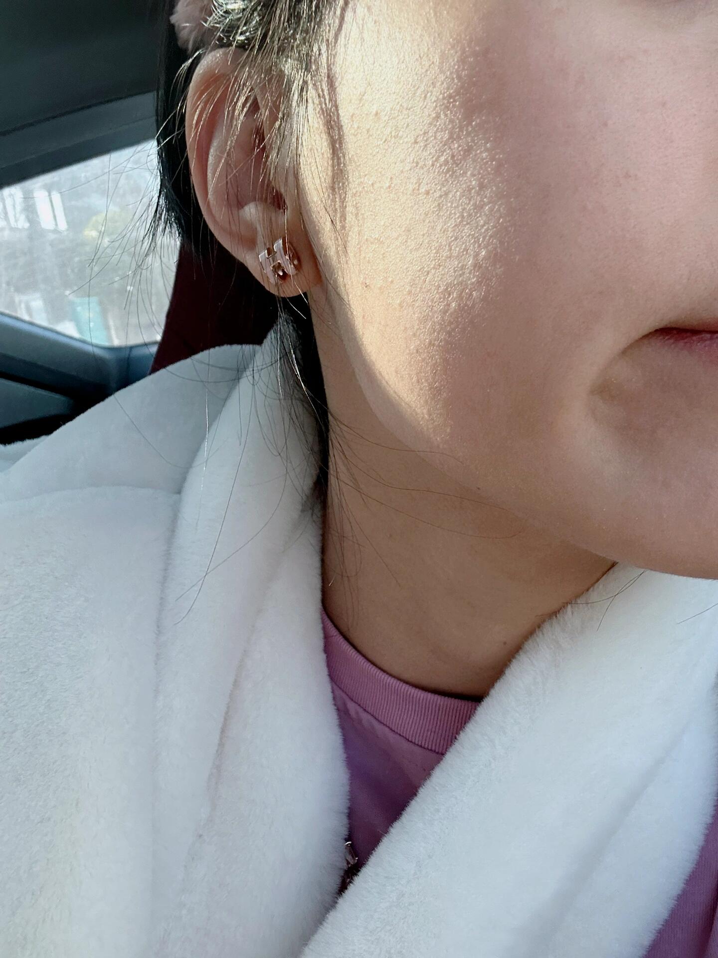 破案了 都是积雪苷片害我 这几天脸上狂爆痘 但不是那种大痘痘 摸上去