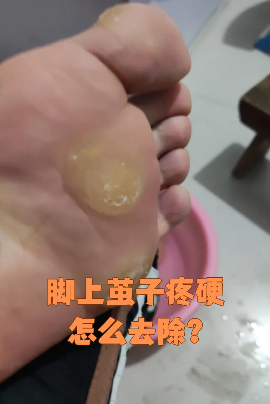 又疼又硬,可以试试这些方法: