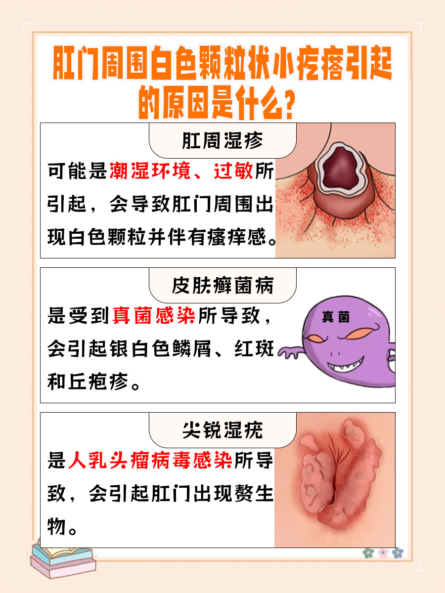 肛门周围白色颗粒状小疙瘩,原因即将揭晓 🍁肛门周围白色颗粒一般
