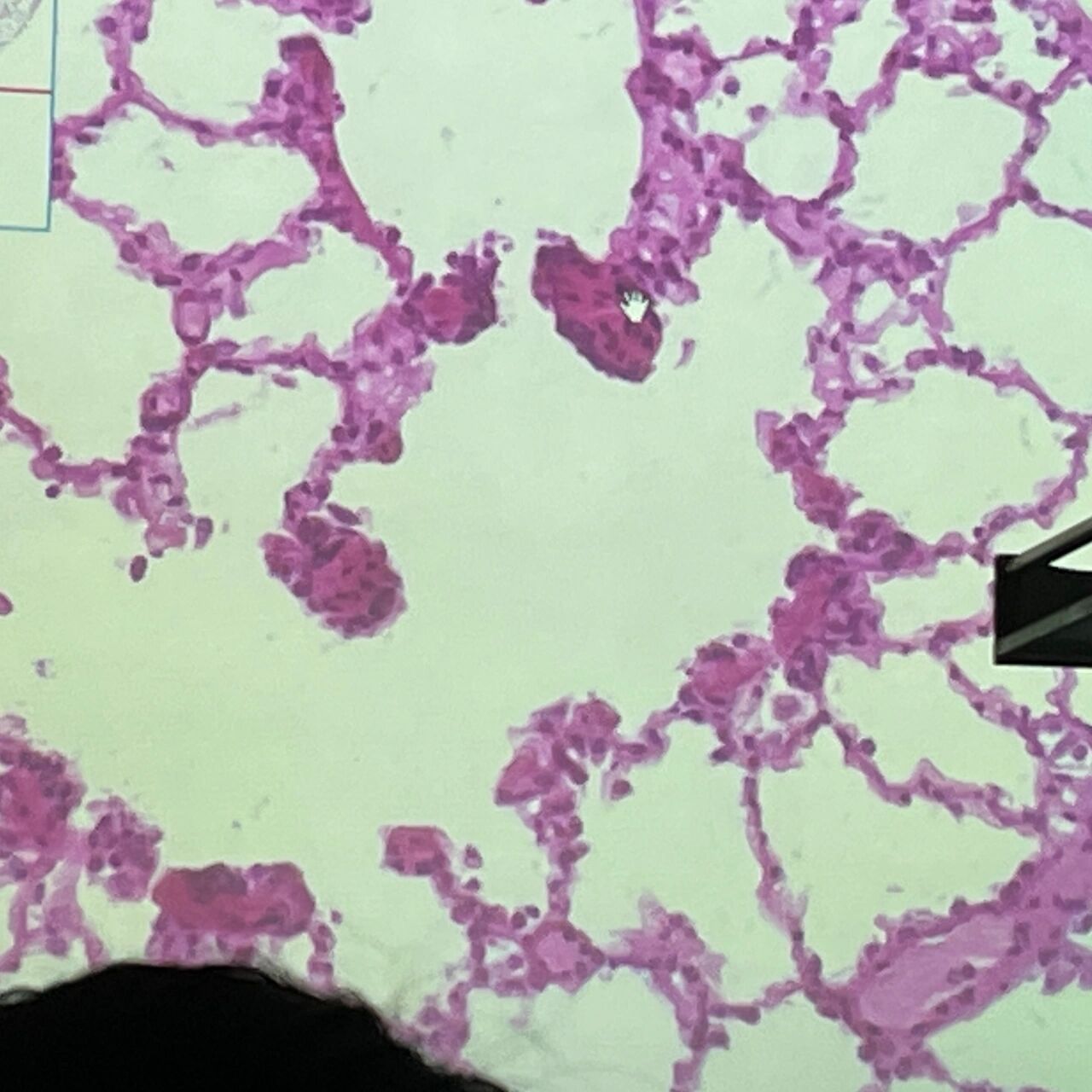 组胚绘图12-肺组织(呼吸部)