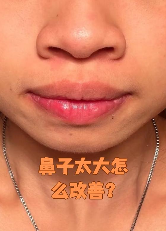 鼻子太大怎么改善?这要看具体原因