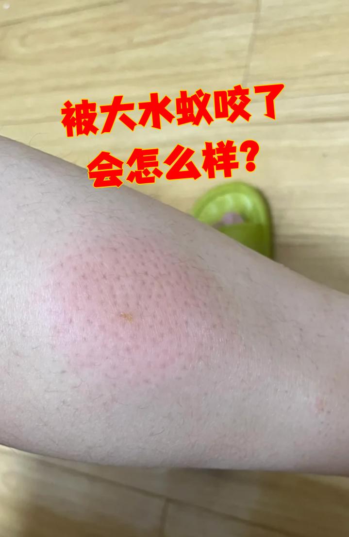 蚂蚁为什么会咬人