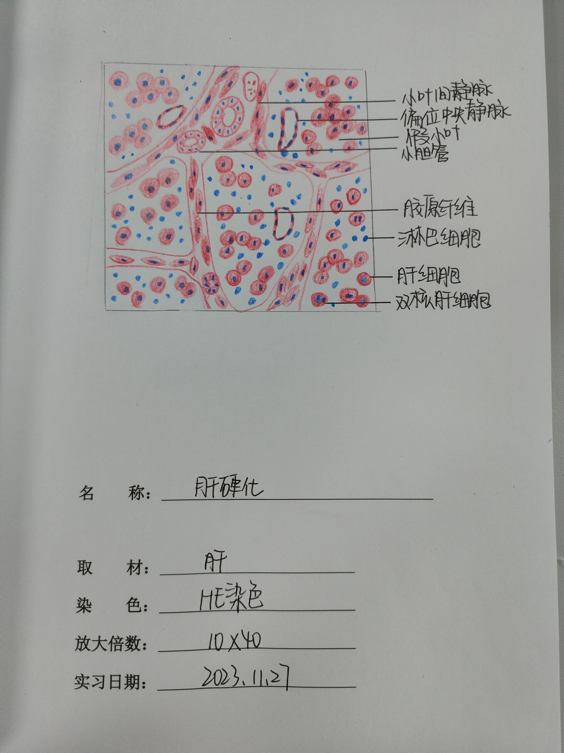 肝脏红蓝铅笔手绘图图片