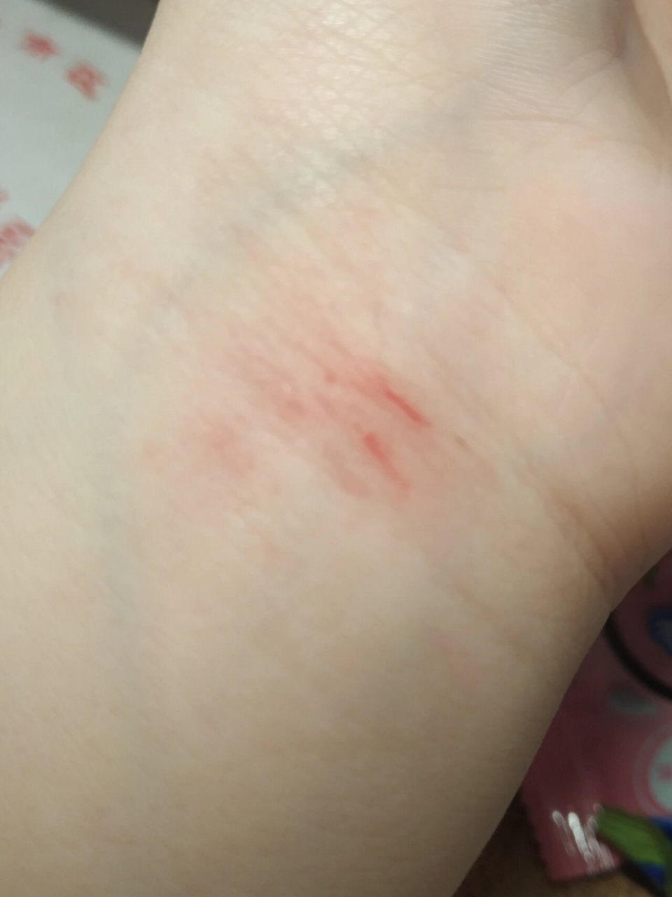 割腕流血了 就怪了这是我画的.一个搞笑女怎么会自杀呢