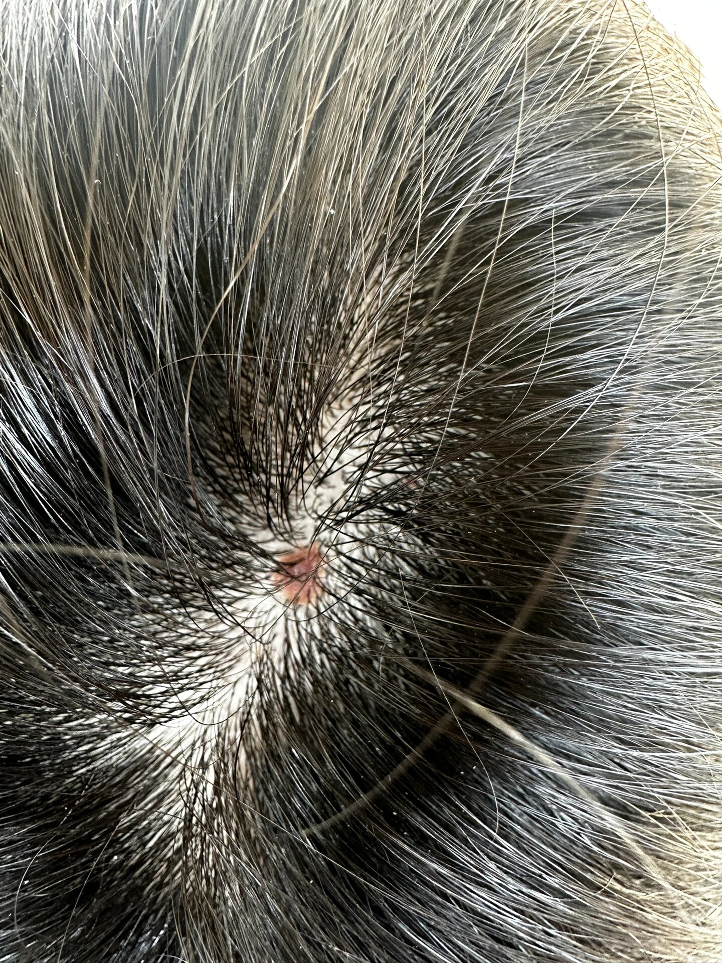 头皮上有这种小红斑,小色块是啥啊?