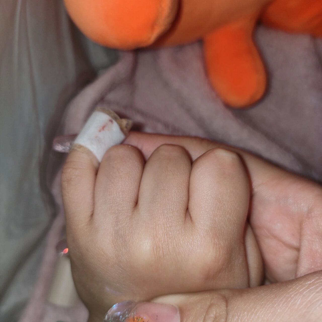 宝宝手指被门夹破皮出血 孩子三周岁多,被门夹破皮流血了,伤口不深是