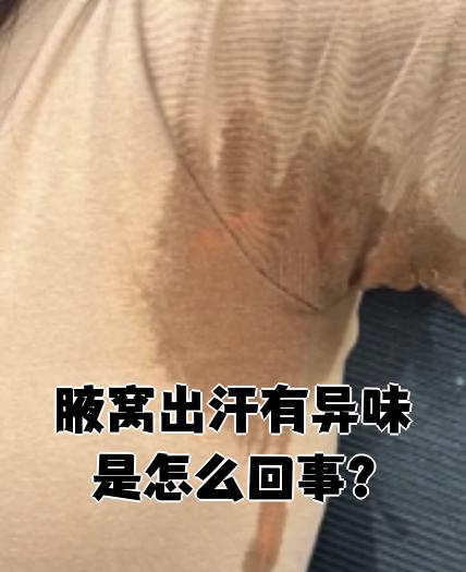 为什么腋下老是出汗