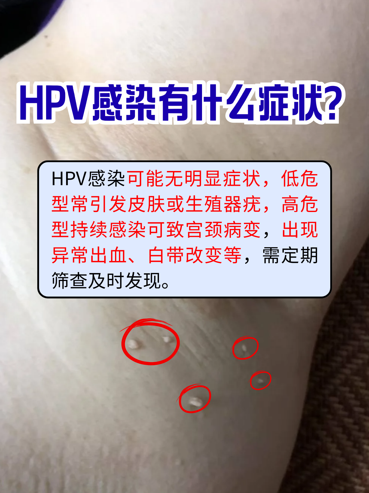  最近感染的病毒有什么症状与治疗(最近几天病毒感染情况)