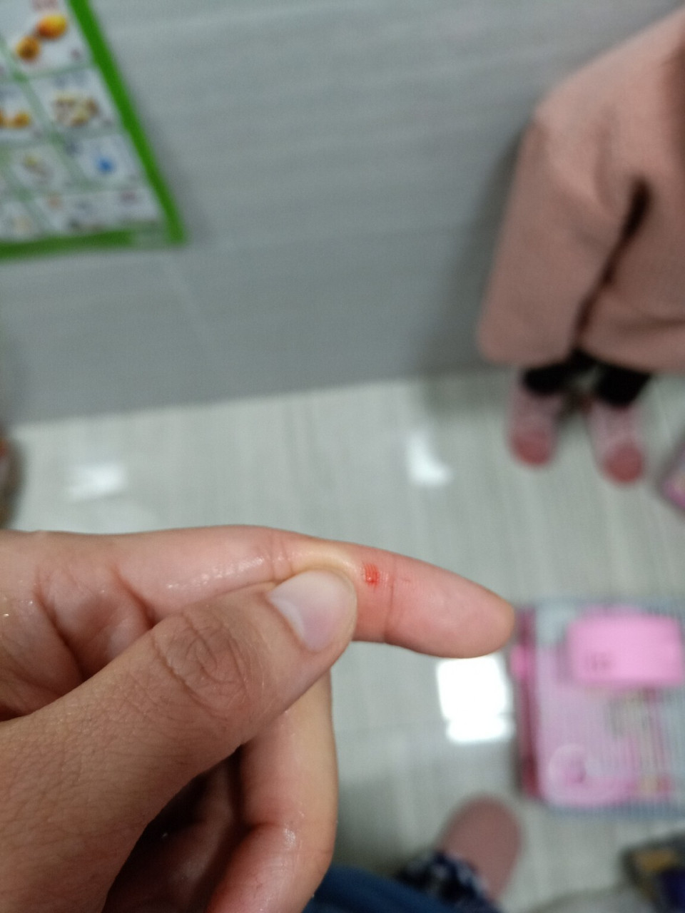 被仓鼠咬了,流血了,需要打针吗 有想过仓鼠的吗,被仓鼠咬了,出血了