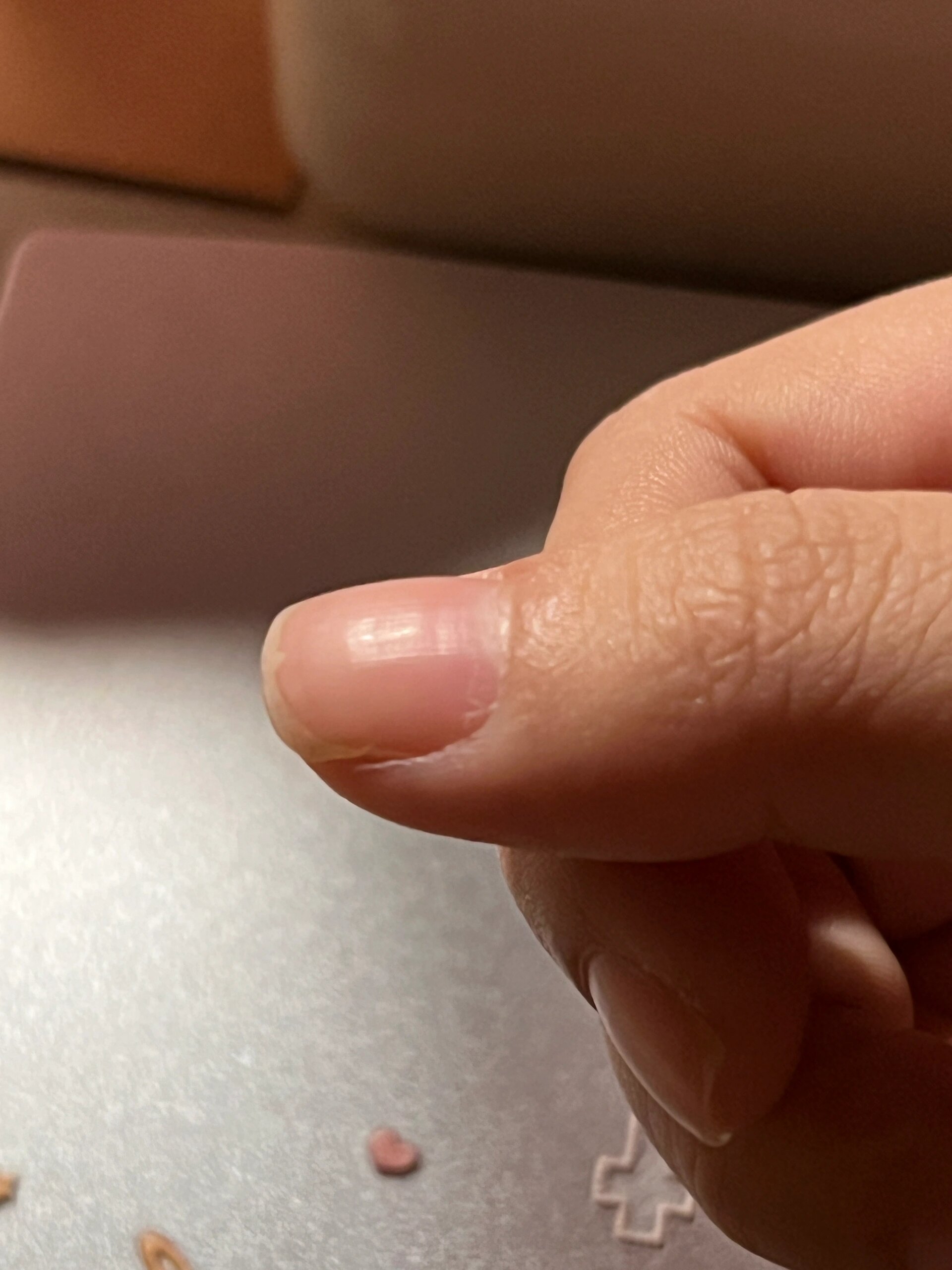 手指甲为什么会凹下去