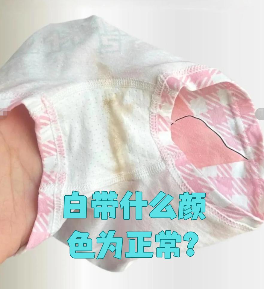正常的白带颜色应该是乳白色或透明蛋清样