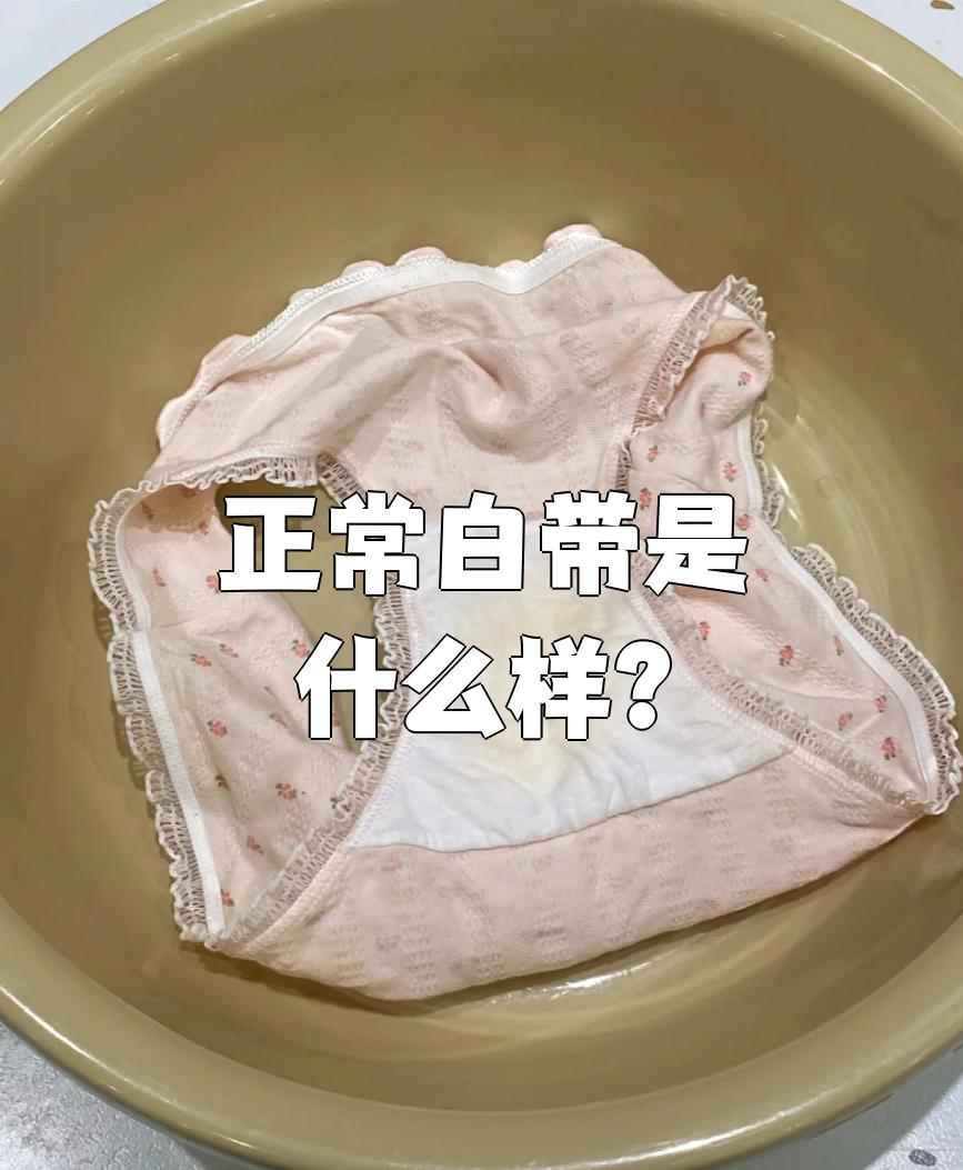 正常的白带是乳白色糊状或像蛋清一样透明的分泌物